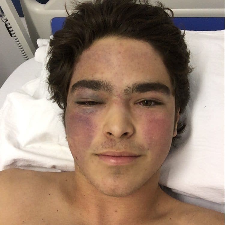 17-річний син легендарного гонщика потрапив в страшну аварію (ФОТО+ВІДЕО)