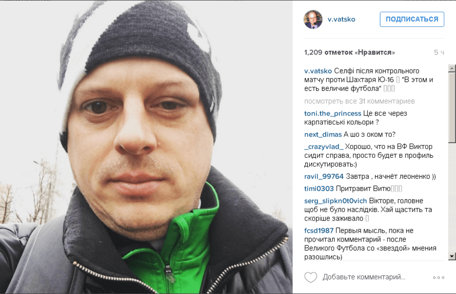 Футболисты “Шахтера” подбили глаз знаменитому украинскому комментатору: фотофакт