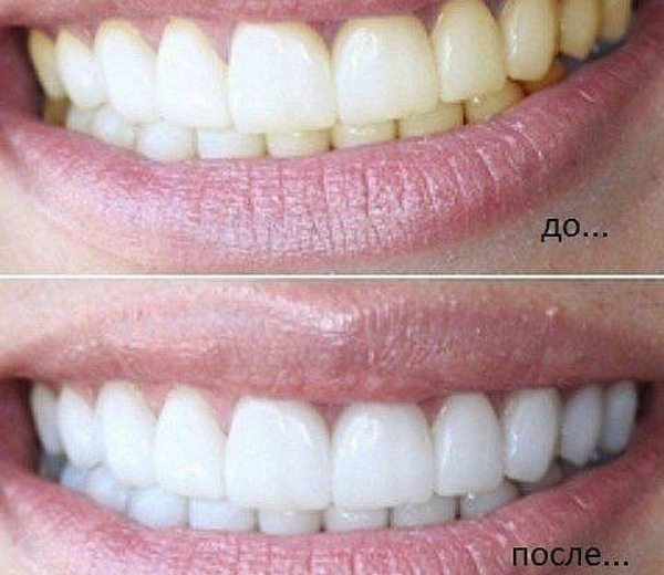 Если добавить эту штуку в зубную пасту, ваши зубы всегда будут белыми!