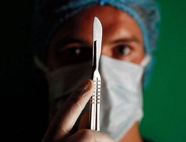 9 відвертих розповідей хірурга-онколога, про роботу лікарів, від яких волосся стає дибки