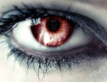 5 причин, чому червоніють очі. Не знехтуйте ними!