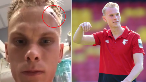 Молодий англійський футболіст отримав серйозну травму голови під час тренувань